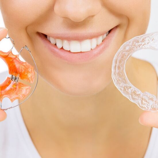 dental retainers